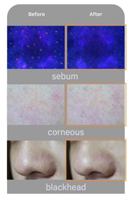 Miracle Laser Cleansing Gel - Image 2